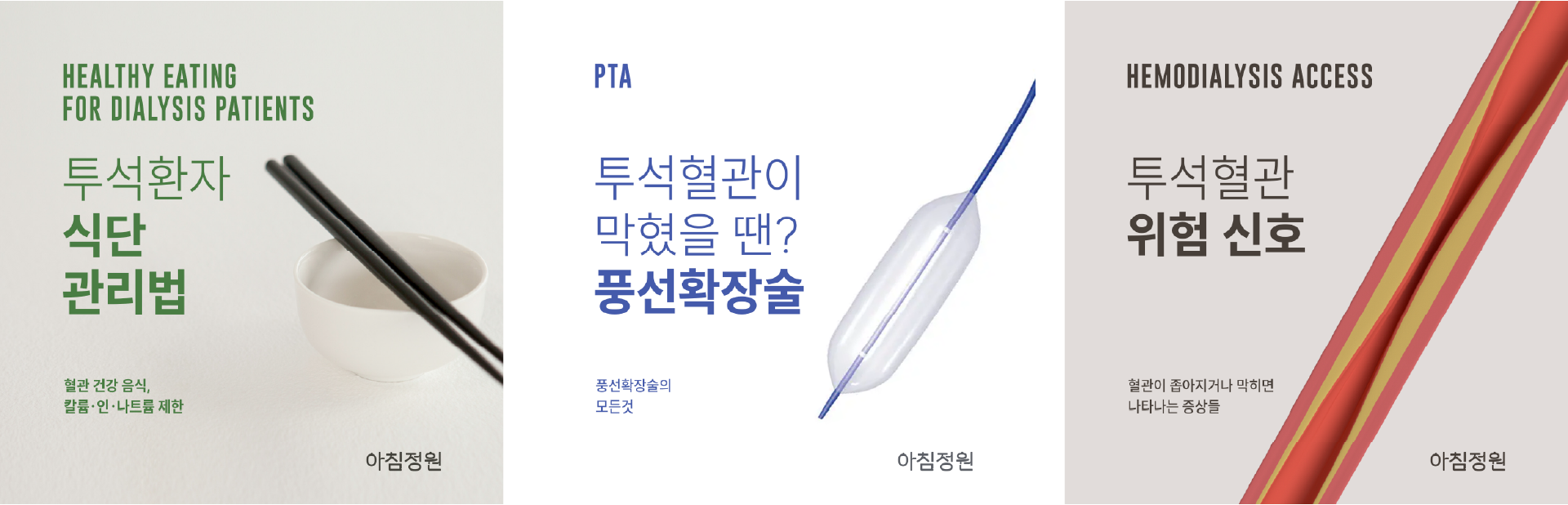 투석혈관 관련 블로그 콘텐츠