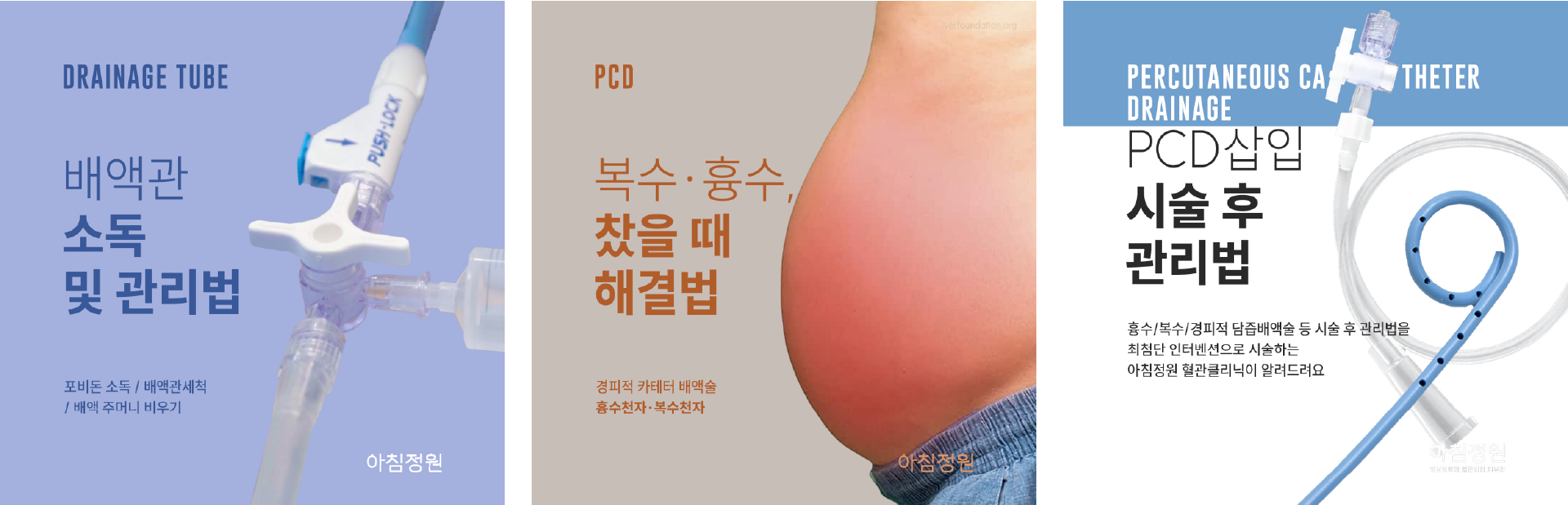 배액관 관련 블로그 콘텐츠
