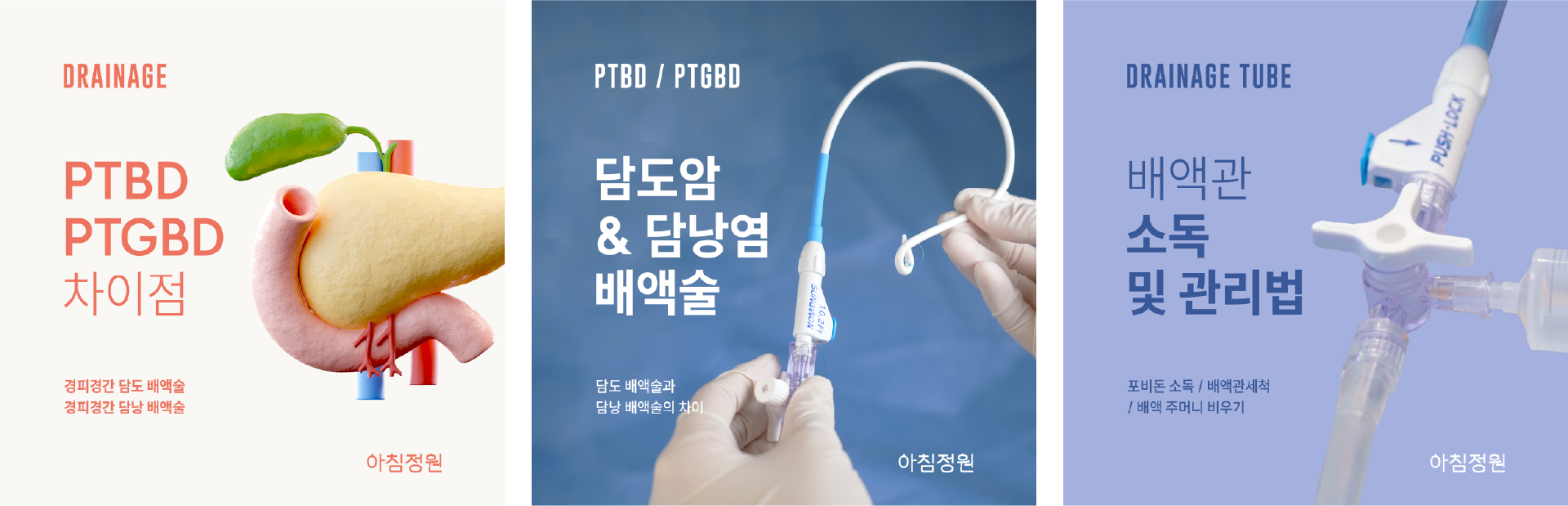 배액관 관련 블로그 콘텐츠