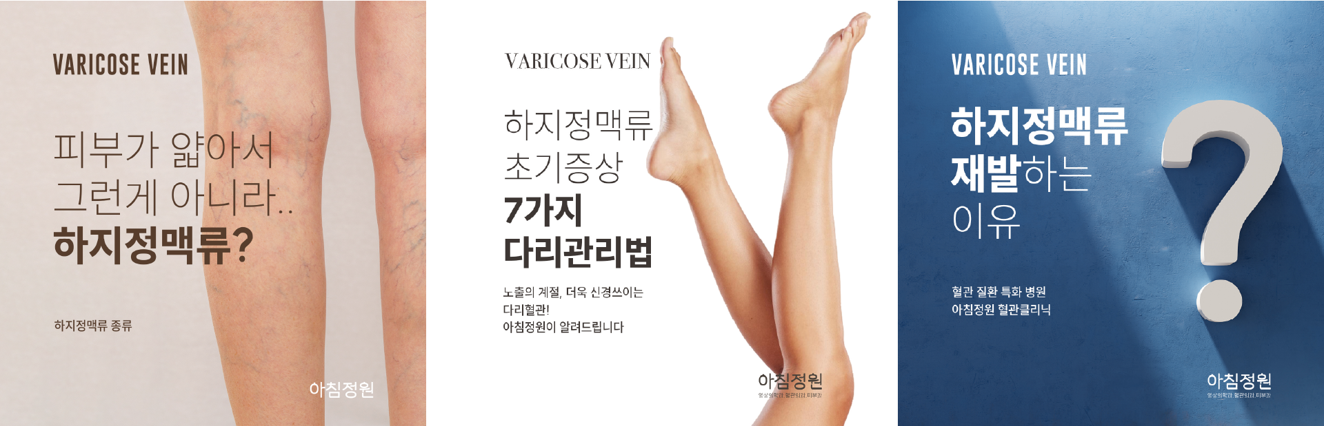 하지정맥류 관련 블로그 콘텐츠